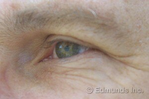 Eye